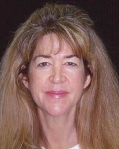 Case--3896 | Before Face Lift and Neck Lift 1