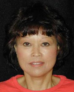 Case--9043 | After Face Lift and Neck Lift 1