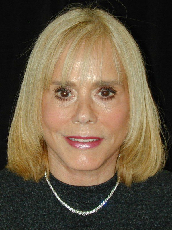 Case--1896 | After Face Lift and Neck Lift 1